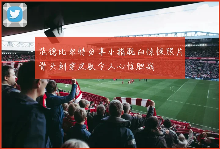 范德比尔特分享小指脱臼惊悚照片骨头刺穿皮肤令人心惊胆战